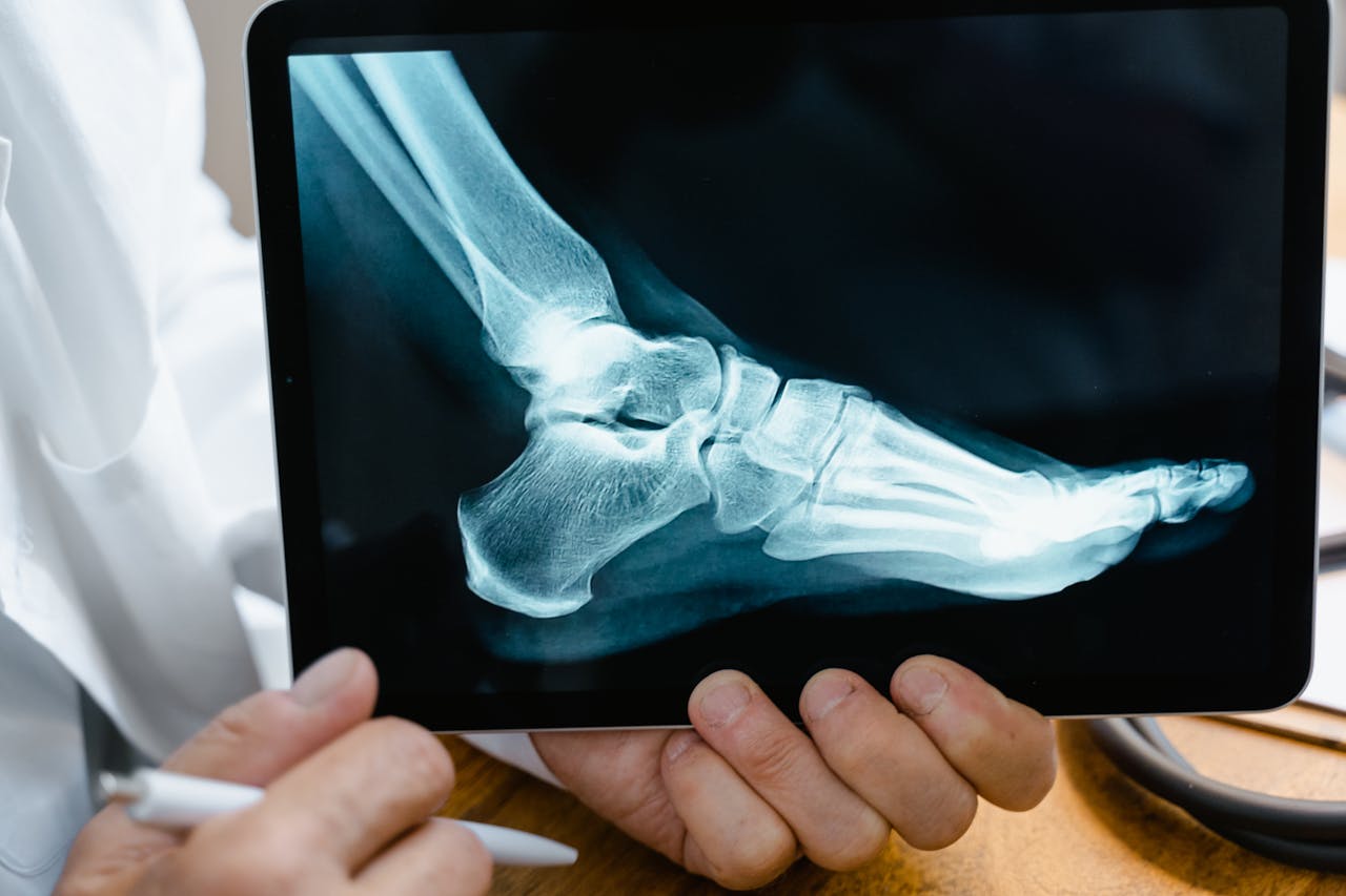 avoid workers compensation claim nanny
